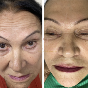 Before after minimal skincare Instagram post